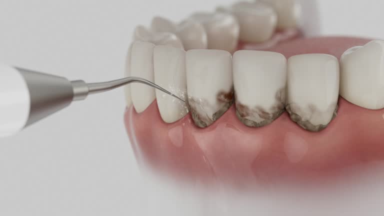 Reliable Dental contractor in Sparks, GA by Dentist Open Now